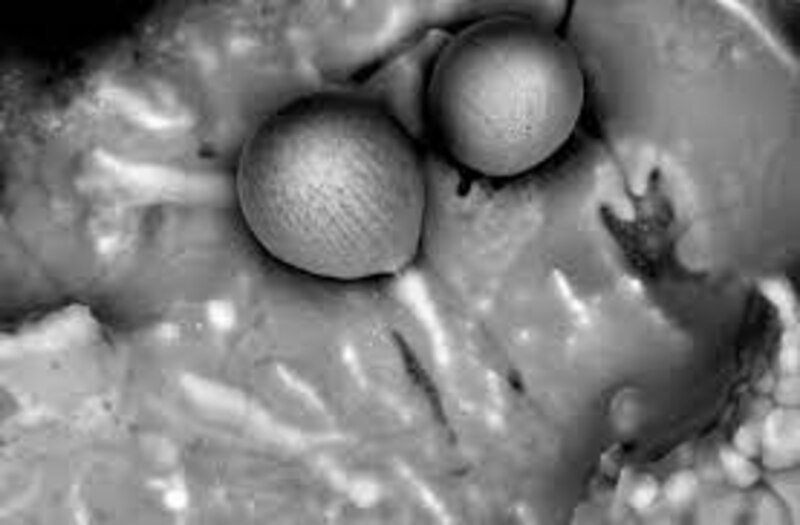 Imagen de microscopio electrónico de barrido de esporas de hongos.