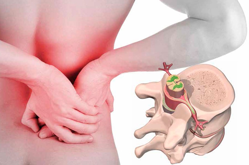 Dolor de espalda: causas, síntomas y tratamiento