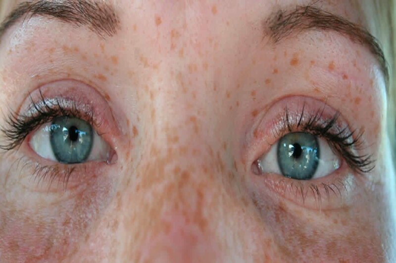Ojos azules y pecas