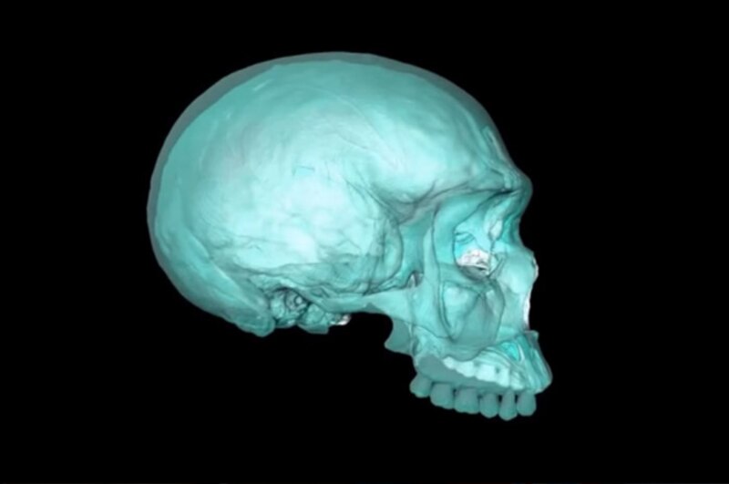 Cráneo humano en 3D