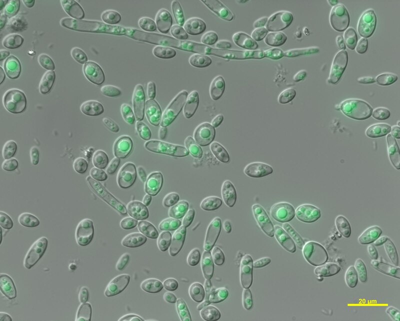 Los lípidos microbianos, también llamados aceites microbianos (SCOs, por sus siglas en inglés Single Cell Oils).