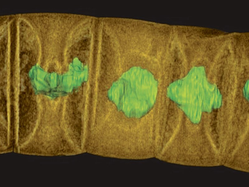 Imagen de microscopio electrónico de barrido de una bacteria con flagelos.