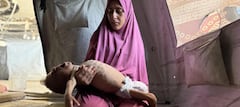 La OMS confirma 400 muertes por malnutrición en Gaza, 80 en menores de cinco años 