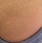 Hay grasa que el cuerpo no puede eliminar, puede ser hipertrigliceridemia 
