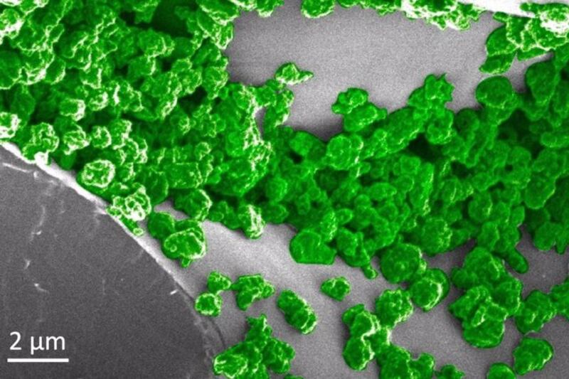 Imagen de microscopio electrónico de barrido de una muestra de células cancerosas.