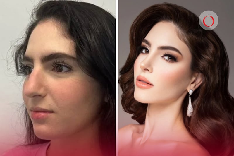 Stephany Abasali, Miss Venezuela