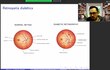 UNAM usa inteligencia artificial para la detección temprana de retinopatía diabética
