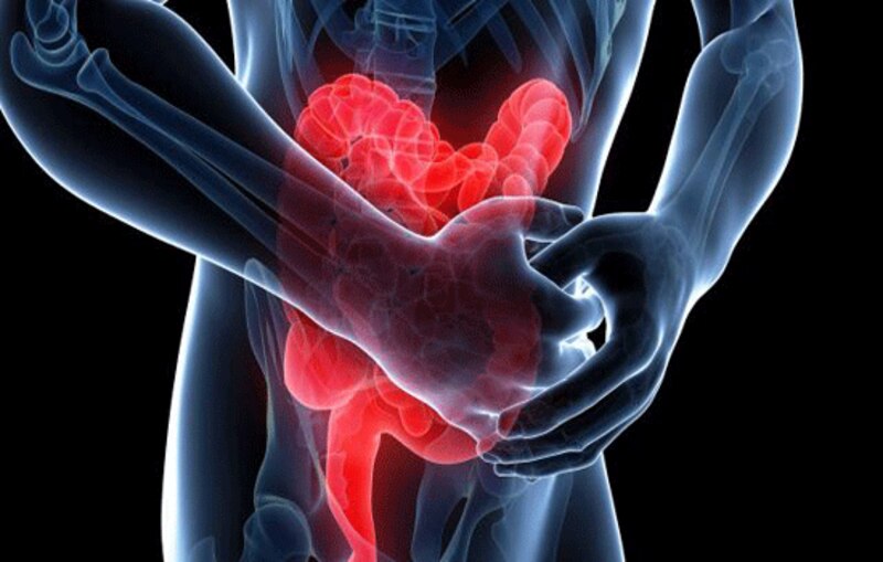 Dolor abdominal