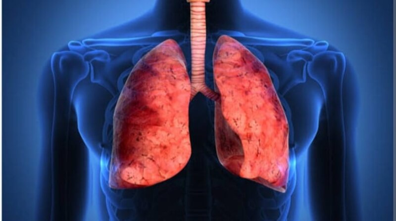 Pulmones