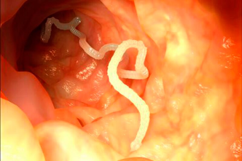 Lombriz intestinal