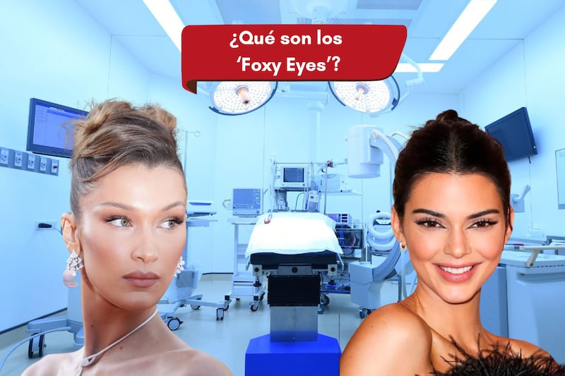 Celebridades que han recurrido al 'Foxy Eyes'