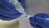 Hepatitis C, enfermedad silenciosa, pero que es tratable si se detecta a tiempo