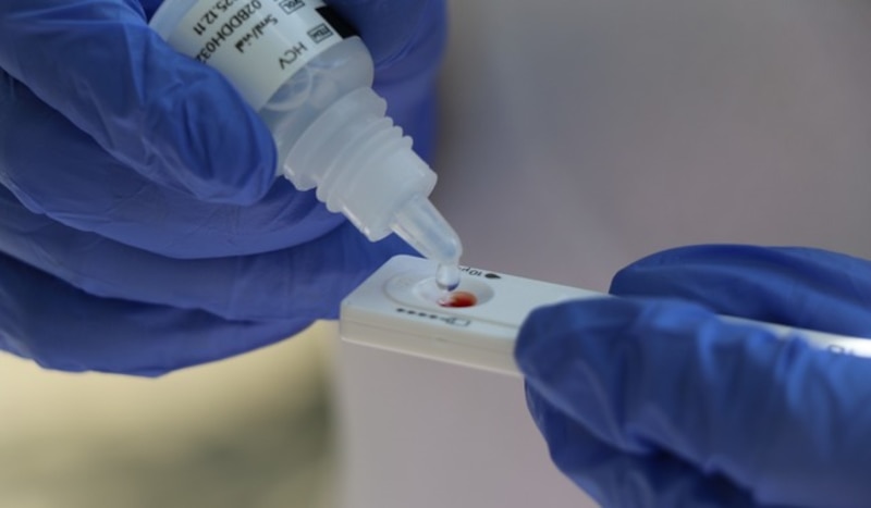 Una prueba rápida de detección del virus de la Hepatitis C, puede salvar tu vida si se detecta a tiempo y evitar complicaciones de salud