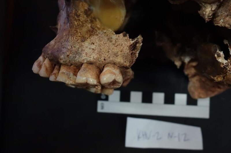 Dientes de un cráneo humano