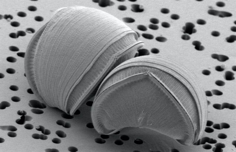 "Imagen de microscopio electrónico de diatomeas"