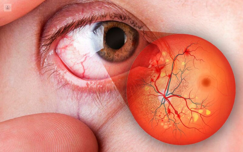 ¿Cómo cuidar la salud de tus ojos?