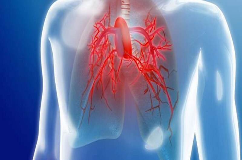Enfermedad pulmonar obstructiva crónica (EPOC)