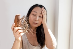 Alopecia: ¿por qué se cae mi cabello y cómo recuperarlo sin morir en el intento?