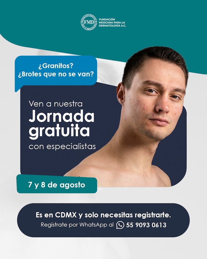 La Fundación Mexicana para la Dermatología brindarán consultas gratis para personas que viven con acné, enfermedad de la piel que no debe considerarse algo “normal de la edad”