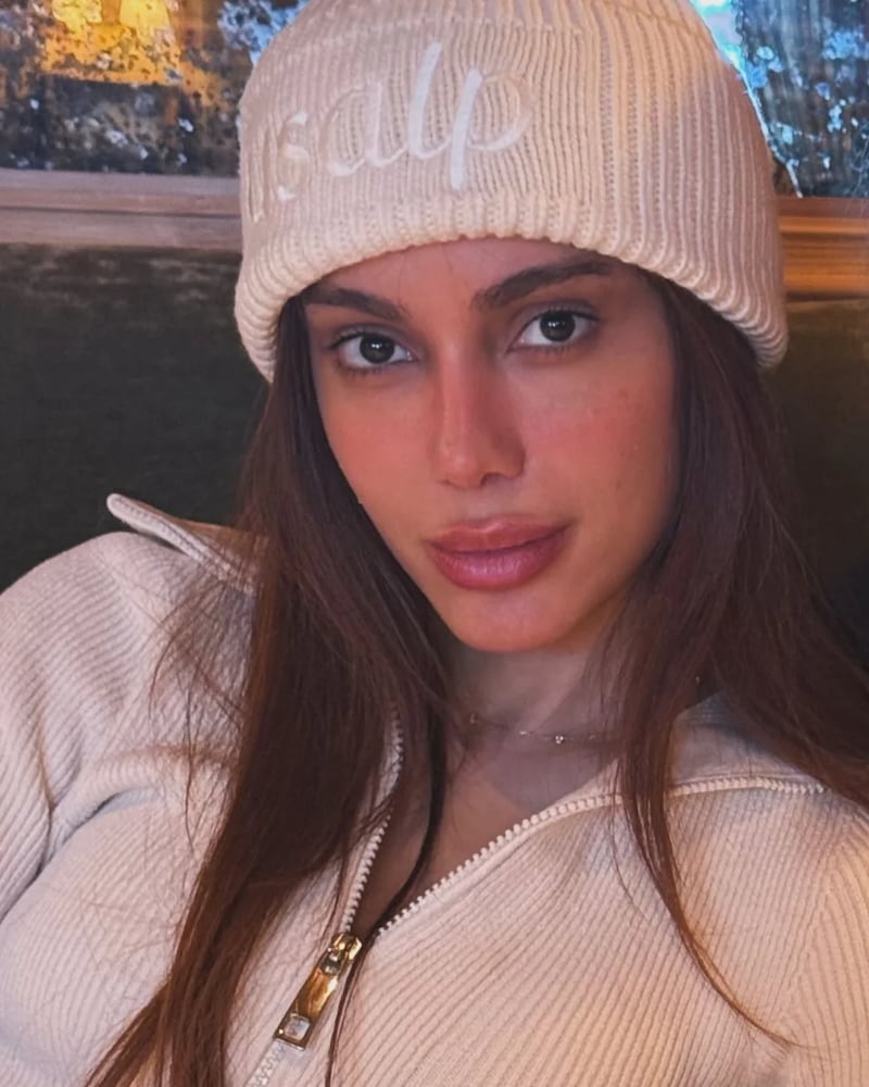 Anitta vuelve a encender el internet con cambio de imagen: “¡Parece otra persona!" aseguran en redes sociales