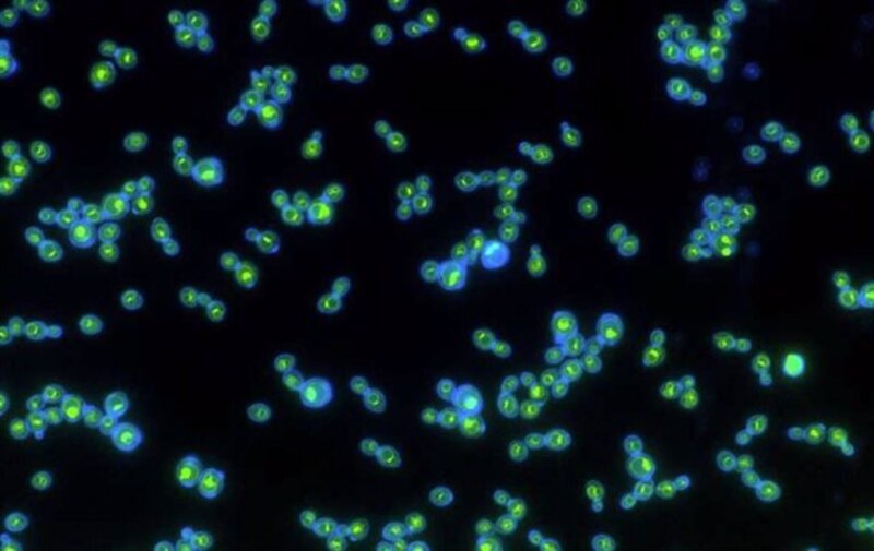"Cultivo de células HeLa en el laboratorio"