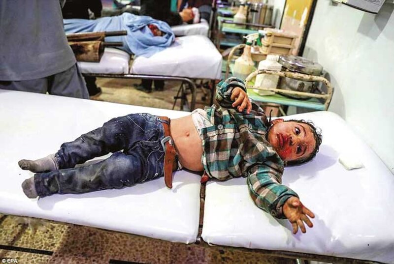 Niño herido en un hospital