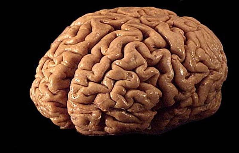 Cerebro humano