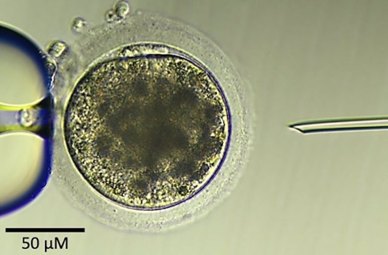 Fecundación in vitro