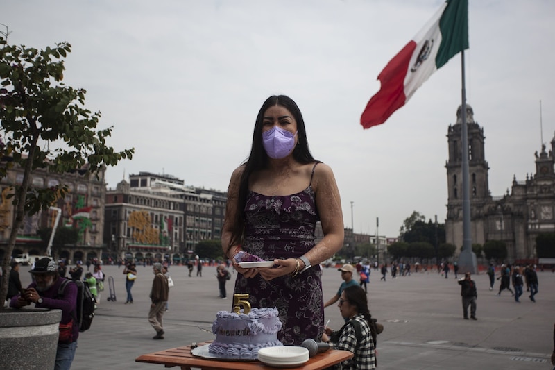 La mujer que sobrevivió a un ataque con ácido comparte su historia