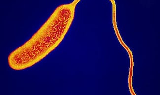 Secretaría de Salud descarta caso de cólera en Tehuacán 